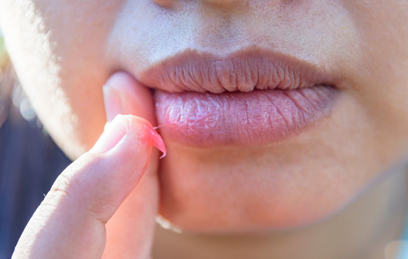 Liệu trị thâm môi bằng vitamin C có thực sự hiệu quả?